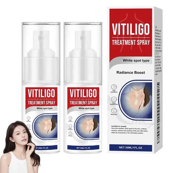 Spray para Tratamento de Vitiligo, Tratamento Natural para Vitiligo na Pele, Melhora a Pigmentação da Pele, Creme para V