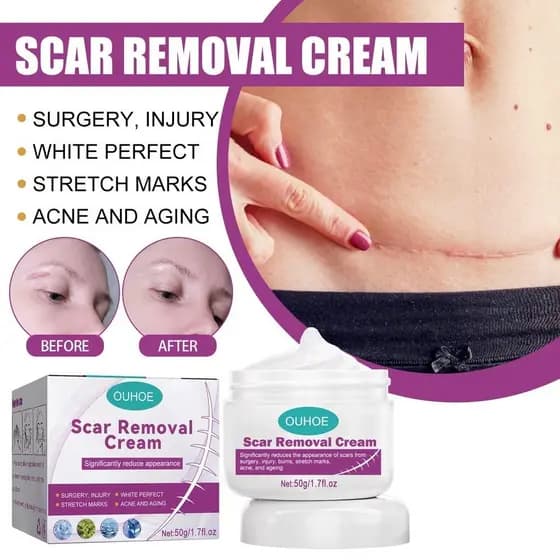 para Eliminar Cicatrizes Negras, Remover Feridas Antigas, Picadas de Mosquito, Cicatrizes Queloides
