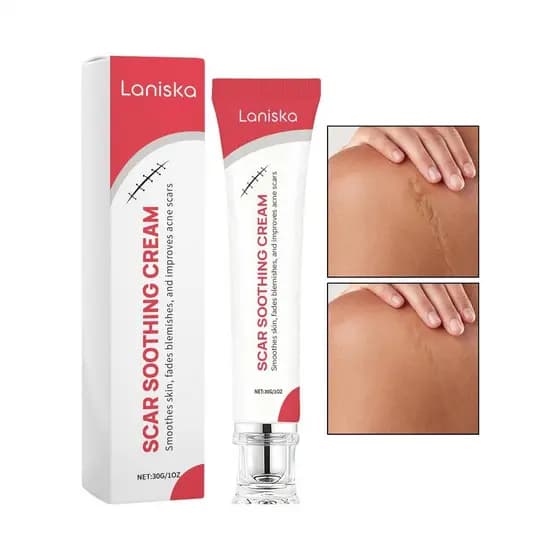 Creme Para Cicatrizes 30g , Calmante , Leve , Reparação De Pele Sensível , Loção , Rosto , Corpo , Queimadura , Estrias