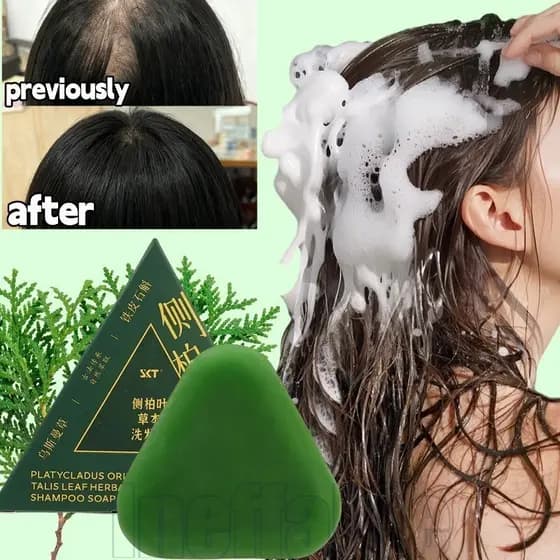 Sabonete Shampoo 1/2/4Pcs-Previne Queda De Cabelo-Controle De Oleosidade , Refrescante , Fofo-Remover Caspa-Calmante Par