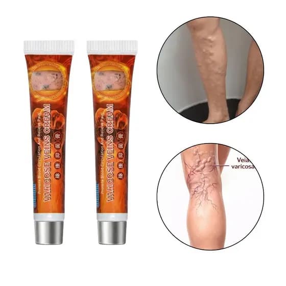 kit 2 Creme Pomada Varizes Veias Vasinhos Pernas Original Envio 24h
