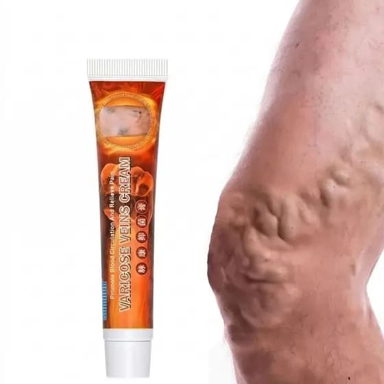 Creme Pomada Para Varizes Tratamento Veias Vasinhos Nas Pernas