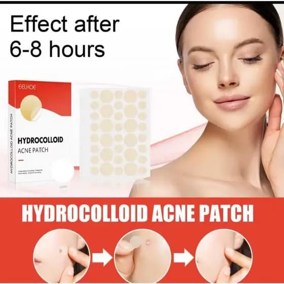 Kit 72 und Adesivo Tratamento de Acne 2 Tamanhos. Invisíveis - Para Homens e Mulheres