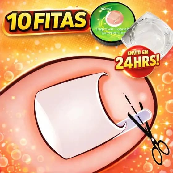 Kit 10/20/30 Órtese Corretora Unha Encravada - Fita e Fibra Formato C Tubular - Tratamento e Alívio