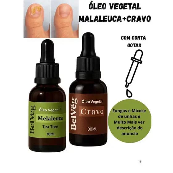 Kit óleo Melaleuca + Cravo 30ml Cada - Fungos e Micose de unhas e Muito Mais