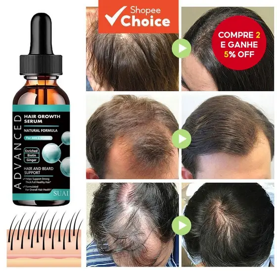 Óleo De Crescimento De Barba Masculino-Fórmula Rápida De Espessamento De Cabelo Para Mais Completa E Cuidados Nutritivos