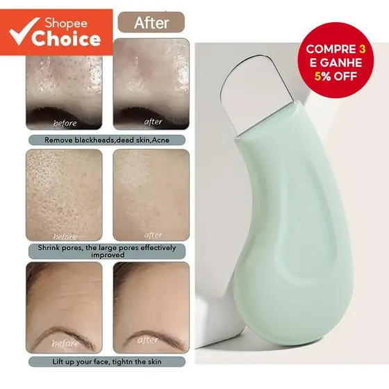 Silicone Cravo Acne Raspador Limpador Facial Casa Salão De Beleza Ferramenta Para Presente De Natal