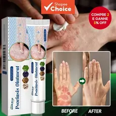 Creme Antibacteriano para Psoríase Lua do Sul Ervas Eficaz Alívio Anti-coceira Tratamento Dermatite Urticária -