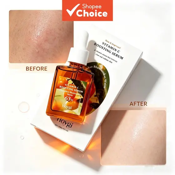 Facial Coreano Hoygi de Vitamina C, 63% Água de Espinheiro Marítimo 30ml, Controle de Oleosidade e Primer de Maquiagem,