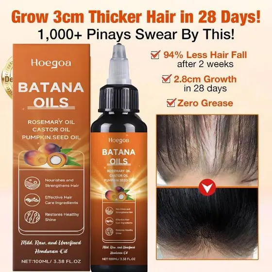 Óleo de Batana para o Crescimento do Cabelo, 4 em 1, com Óleo de Alecrim, Óleo de Rícino e Óleo de Semente de Abóbora