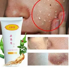 Esfoliante Facial de GengibreGel Esfoliante com Ácido Hialurônico, Sabonete Facial Nutritivo, Sabonete Facial Hidratante