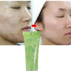 Creme 13G Aloe Vera 92% Concentrado Hidratante Para O Rosto