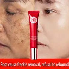 Creme anti-rugas forte idade original para remover manchas escuras pigmentação brilhante Cuidados com a pele Mantenha a