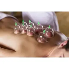 Conjunto de ventosas corporais