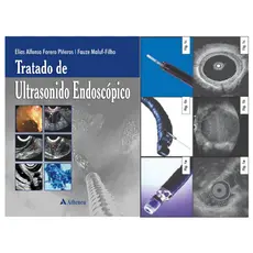 Tratado de Ultrasonido Endoscópico técnicas de diagnósticos perspectivas terapêuticas, EliasAlfonso F. Piñeros, Fauze M.