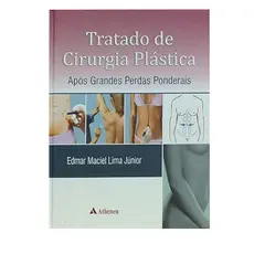 Tratado De Cirurgia Plástica Após Grandes Perdas Ponderais, De Lima Júnior, Edmar Maciel. Editora Atheneu Ltda Capa dura