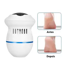 Lixa De Pé Elétrica Removedor De Calos E Pele Morta Recarregável USB Profissional Cuidados Com Os Pés EsfoliadorJIMMY