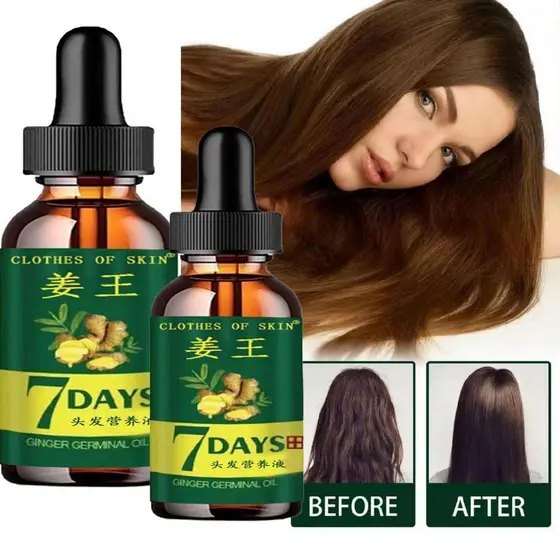 Óleo Natural De Essência Capilar De Gengibre Para Anti-Queda De Cabelo , Prevenção , Tratamento De Calvície , Cuidados N