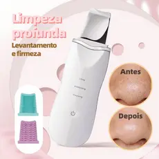 Aparelho Removedor de Cravos Ultrassônico Peeling Facial Profissional Limpeza de Pele Profunda Antirrugas Espátula