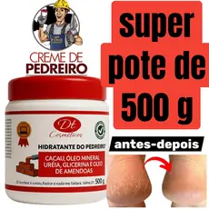 Creme De Ureia 500g Hidratante do Pedreiros Com Ureia Amêndoas Cacau Para mãos e Pés