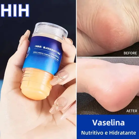 Vaselina Moisturizing Stick – Creme Protetor Intensivo Para Mãos E Pés , Prevenção De Rachaduras , Hidratação Profun