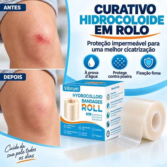 Fita Adesiva Hidrocolóide Para Cicatrizes , Rolo 5x150cm , Folhas Macias Cirúrgicas , De Acne , Adere Firmemente E Não C