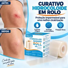 Fita Adesiva Hidrocolóide Para Cicatrizes , Rolo 5x150cm , Folhas Macias Cirúrgicas , De Acne , Adere Firmemente E Não C