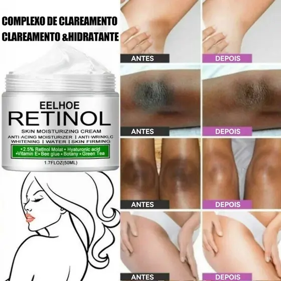 Creme de clareamento corporal / axilas / clareamento / clareamento / lado interno / áreas íntimas/joelhos