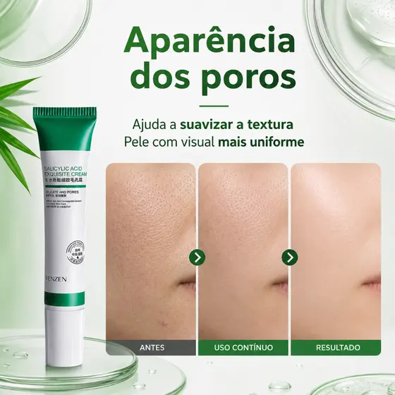 Creme com Ácido Salicílico – 20 g– Indicado para peles oleosas e mistas