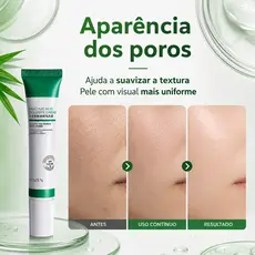 Creme com Ácido Salicílico – 20 g– Indicado para peles oleosas e mistas