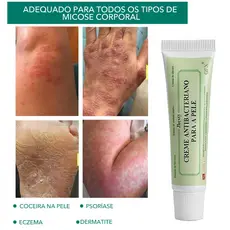 Creme Para A Pele , Antibacteriano Eczema Nu , Pomada Dermatite Eczematoide , Cuidado Com Inibição De Aprendizagem Volu