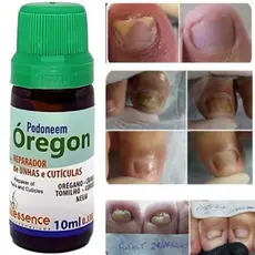 Reparador De Unhas E Cutículas Podoneem Óregon 10ml Pró Essence