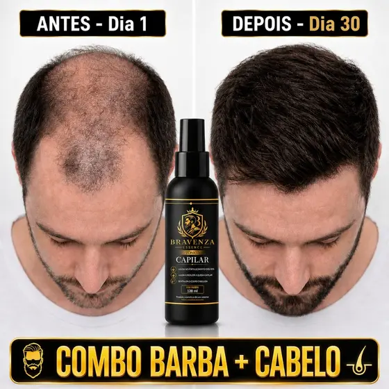 Bravenza Essence Tônico Capilar Cresce Cabelo Barba Bigode Cavanhaque Preenche Falhas Unissex 9