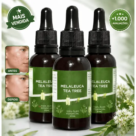 Óleo Essencial De Melaleuca 100% Puro 30ml Contra Micose e Acne ENVIO RÁPIDO!!