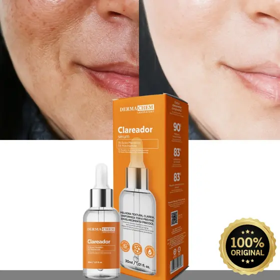 Sérum Clareador Dermachem de Melasma Uniformiza o tom da Pele Clareia Manchas Clareador Niacinamida