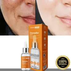 Sérum Clareador Dermachem de Melasma Uniformiza o tom da Pele Clareia Manchas Clareador Niacinamida