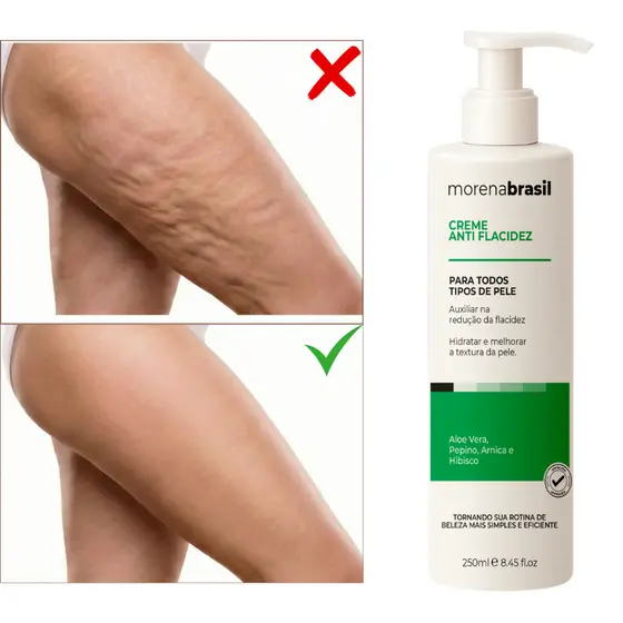 Creme Anti Flacidez Morena Brasil -  Diga Adeus à Flacidez na Barriga, Coxas & Braços!!!