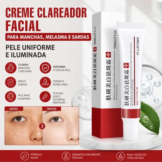 Creme Clareador Facial para Manchas, Melasma e Sardas – Pele Uniforme e Iluminada
