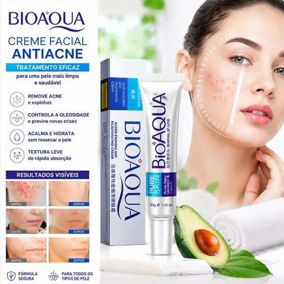 Bioaqua Creme De Remoção De Espinhas Para Cicatrizes Tratamento Anti-Acne Clareamento Controle De Oleosidade【in