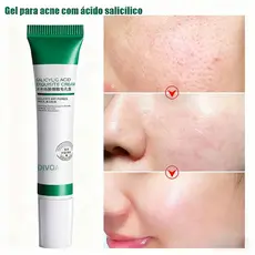 Creme de Ácido Salicílico para Redução de Poros - Loção Facial Hidratante Redução de Poros Dilatados