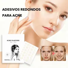 2/3/5 pcs de adesivos aquosos para acne, adesivos principais para acne, conjunto, adesivos redondos para acne