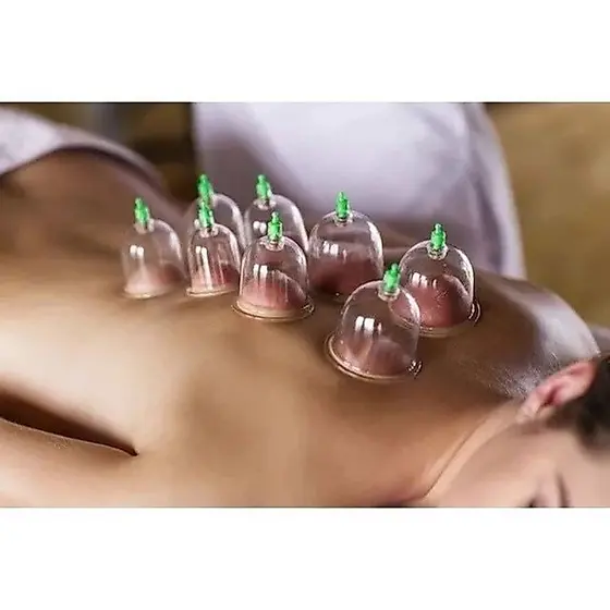 Conjunto de ventosas corporais