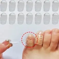 Kit 10 Dedeiras de Silicone Protetor Calo Unha Encravada Para Dedo Dos Pés, olho de peixe bolhas