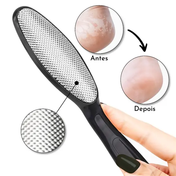 Lixa Raspador De Pés Tratamento Eficaz Contra Calos E Pele Grossa Manicure Pedicure