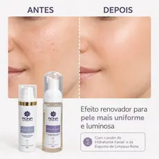 KIT SABONETE ESPUMA DE LIMPEZA FACIAL E HIDRATANTE NUTRITIVO RONA CARE COSMÉTICOS 1119-A