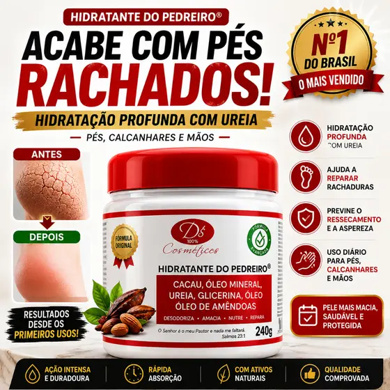 *Creme do Pedreiro Original para Pés Rachados e Mãos Ressecadas com Ureia