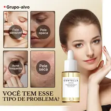 Centella Asiatica Essência Facial Iluminadora Hidratante Suavizante Essência Facial |Acaba com Vermelhidão | Inverno