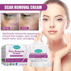 Creme Para Remoção De Cicatrizes-Desbota Escuras , Feridas Antigas , Picadas De Mosquitos , Quelóides E De Queimaduras