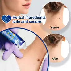 Creme Renovador De Pele – Reduz Imperfeições E Suaviza A Textura Da