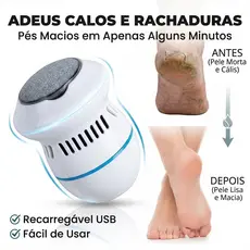 Removedor De Calos Elétrico USB Recarregável Lixa Para Pés Pele Morta Pedicure
